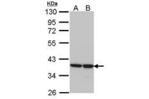 Image no. 1 for anti-Aldo-Keto Reductase Family 1, Member B1 (Aldose Reductase) (AKR1B1) (AA 1-298) antibody (ABIN467605) (AKR1B1 antibody  (AA 1-298))