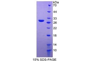 SDS-PAGE (SDS) image for Glutathione S-Transferase omega 1 (GSTO1) (AA 24-233) protein (His tag) (ABIN2125021) (GSTO1 Protein (AA 24-233) (His tag))