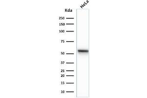 Western Blot Analysis of human HeLa cell lysate using Cytokeratin 7 Mouse Monoclonal Antibody (K72. (Cytokeratin 7 antibody)