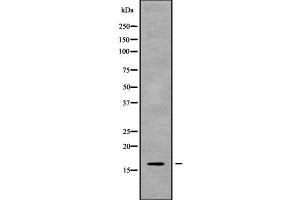 Western blot analysis of CST8 using Jurkat whole cell lysates (CST8 antibody  (Internal Region))