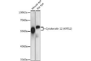 Western blot analysis of extracts of various cell lines, using Cytokeratin 12 (Cytokeratin 12 (KRT12)) antibody (ABIN7268088) at 1:1000 dilution. (KRT12 antibody  (AA 295-494))