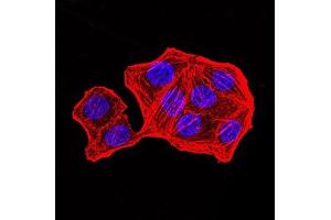 Immunofluorescence (IF) image for anti-PMS2 Postmeiotic Segregation Increased 2 (S. Cerevisiae) (PMS2) (AA 748-851) antibody (ABIN7193481)