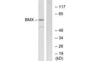 Western blot analysis of extracts from COS-7 cells, using BMX antibody. (BMX antibody  (N-Term))