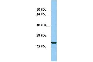 Host: Rabbit Target Name: B9D1 Sample Type: 721_B Whole Cell lysates Antibody Dilution: 1. (B9D1 antibody  (N-Term))