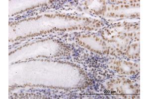 Immunoperoxidase of monoclonal antibody to OXSR1 on formalin-fixed paraffin-embedded human stomach. (OXSR1 antibody  (AA 351-450))