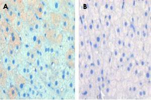 Formalin-fixed and paraffin-embedded cow lactatingreacted with CPT1A polyclonal antibody , which was peroxidase-conjugated to the secondary antibody, followed by AEC staining. (CPT1A antibody  (C-Term))