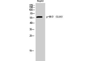 Western Blotting (WB) image for anti-Estrogen Receptor 2 (ESR2) (pSer105) antibody (ABIN5960540) (ESR2 antibody  (pSer105))