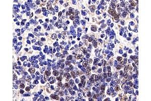 Immunohistochemistry analysis of paraffin-embedded Rat spleen cancer using p27 Polyclonal Antibody at dilution of 1:200.