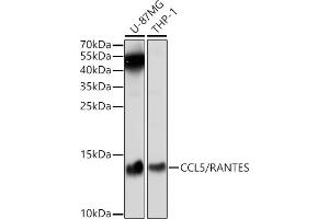 Western blot analysis of extracts of various cell lines, using CCL5/RANTES antibody (ABIN6129370, ABIN6138064, ABIN6138066 and ABIN6221267) at 1:1000 dilution. (CCL5 antibody  (AA 24-91))