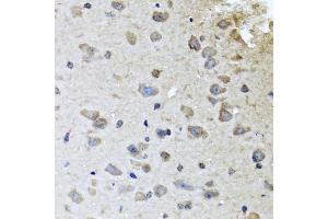 Immunohistochemistry of paraffin-embedded mouse brain using BRCA1 antibody (ABIN5970045) at dilution of 1/100 (40x lens). (BRCA1 antibody)