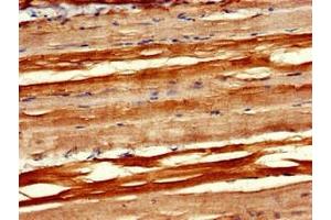 Immunohistochemistry of paraffin-embedded human skeletal muscle tissue using ABIN7166859 at dilution of 1:100 (PXK antibody  (AA 1-200))