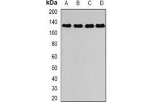 Western blot analysis of DAAM2 expression in A375 (A), mouse kidney (B), mouse lung (C), rat brain (D) whole cell lysates.