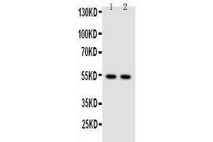 Anti-NFkB p100/p52 antibody,  Western blotting Lane 1: HELA Cell Lysate Lane 2: JURKAT Cell Lysate (NFKB2 antibody  (N-Term))