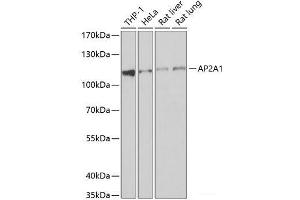 Western blot analysis of extracts of various cell lines using AP2A1 Polyclonal Antibody at dilution of 1:1000.