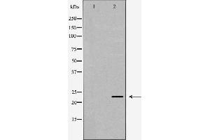 Western blot analysis of extracts of SW480, using LCN2 antibody. (Lipocalin 2 antibody  (Internal Region))