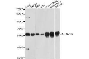 Western blot analysis of extracts of various cell lines, using ATP6V1B2 Antibody (ABIN5971942) at 1/1000 dilution. (ATP6V1B2 antibody)