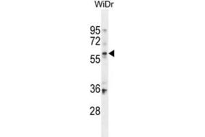 Western Blotting (WB) image for anti-beta-Carotene 15,15'-Monooxygenase 1 (BCMO1) antibody (ABIN2995663)
