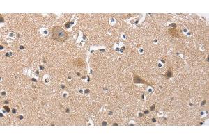 Immunohistochemistry of paraffin-embedded Human brain tissue using BUB1 Polyclonal Antibody at dilution 1:50 (BUB1 antibody)
