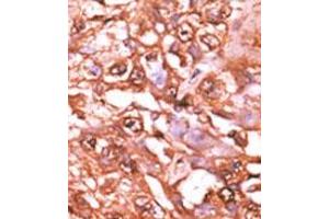 Image no. 2 for anti-Signal Transducer and Activator of Transcription 5A (STAT5A) (pSer726) antibody (ABIN358237) (STAT5A antibody  (pSer726))