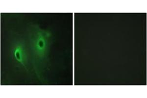 Immunofluorescence analysis of HeLa cells, using DUSP9 Antibody . (DUSP9 antibody  (Internal Region))
