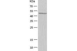 Western Blotting (WB) image for CD276 (CD276) (AA 30-466) protein (His tag) (ABIN7287543) (CD276 Protein (CD276) (AA 30-466) (His tag))