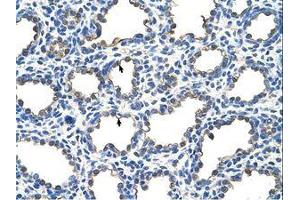 Image no. 1 for anti-Epithelial Membrane Protein 2 (EMP2) (C-Term) antibody (ABIN203481) (EMP2 antibody  (C-Term))