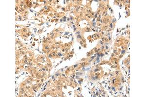 Immunohistochemistry (IHC) image for anti-Tropomyosin-2 (TPM2) antibody (ABIN3017365) (TPM2 antibody)