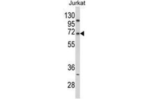 Western Blotting (WB) image for anti-Proprotein Convertase Subtilisin/kexin Type 9 (PCSK9) (N-Term) antibody (ABIN453778)