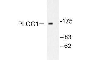 Image no. 2 for anti-phospholipase C, gamma 1 (PLCG1) antibody (ABIN271786) (Phospholipase C gamma 1 antibody)
