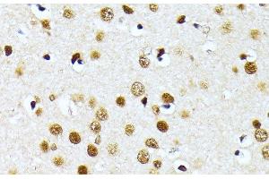 Immunohistochemistry of paraffin-embedded Mouse brain using PRMT1 Polyclonal Antibody at dilution of 1:100 (40x lens).