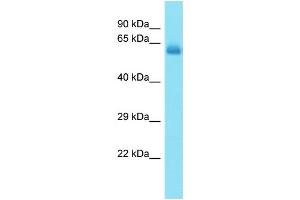 Host: Rabbit Target Name: CCDC155 Sample Type: Fetal Heart lysates Antibody Dilution: 1. (CCDC155 antibody  (C-Term))