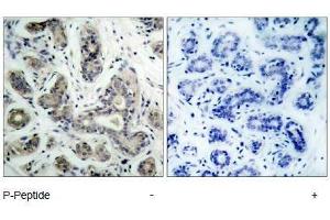 Image no. 1 for anti-BCL2-Associated Agonist of Cell Death (BAD) (pSer136), (pSer99) antibody (ABIN318335) (BAD antibody  (pSer99, pSer136))