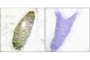 Immunohistochemistry analysis of paraffin-embedded human skin, using HDAC3 (Phospho-Ser424) Antibody. (HDAC3 antibody  (pSer424))