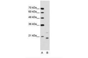 Image no. 1 for anti-Ubiquitin-Conjugating Enzyme E2D 1 (UBE2D1) (AA 91-140) antibody (ABIN203473) (UBE2D1 antibody  (AA 91-140))