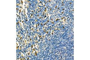 Immunohistochemistry of paraffin embedded mouse spleen using CD42d (ABIN7074111) at dilution of 1:700 (400x lens) (GP5 antibody)