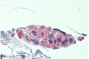 Human Small Intestine, submucosal plexus: Formalin-Fixed, Paraffin-Embedded (FFPE) (TNKS antibody  (AA 972-1021))