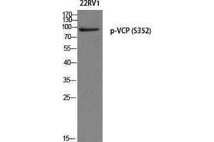 Western Blot (WB) analysis of 22RV1 using p-VCP (S352) antibody. (VCP antibody  (pSer352))