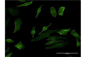 Immunofluorescence of monoclonal antibody to P2RY1 on HeLa cell. (P2RY1 antibody  (AA 1-52))