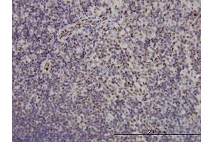 Immunoperoxidase of monoclonal antibody to TSC22D3 on formalin-fixed paraffin-embedded human lymph node. (TSC22D3 antibody  (AA 1-97))