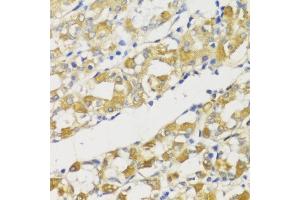 Immunohistochemistry (IHC) image for anti-SNAIL (SNAI1) (C-Term) antibody (ABIN6148177)