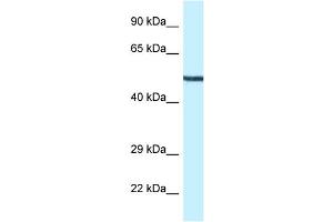 WB Suggested Anti-Map2k5 Antibody Titration: 1.