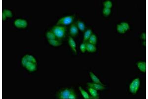 Immunofluorescent analysis of HepG2 cells using ABIN7159092 at dilution of 1:100 and Alexa Fluor 488-congugated AffiniPure Goat Anti-Rabbit IgG(H+L) (TMEM67 antibody  (AA 241-500))