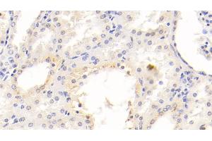 Detection of Kim1 in Human Kidney Tissue using Monoclonal Antibody to Kidney Injury Molecule 1 (Kim1) (HAVCR1 antibody  (AA 21-240))