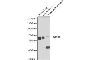 Western blot analysis of extracts of various cell lines, using SLC9 antibody (ABIN6131139, ABIN6148056, ABIN6148057 and ABIN6224211) at 1:1000 dilution.
