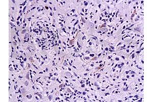 Formalin-fixed and paraffin embedded rat brain tissue labeled with Anti-MMP-2 Polyclonal Antibody (ABIN668286), Unconjugated at 1:200, followed by conjugation to the secondary antibody and DAB staining