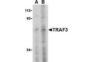 Western blot analysis of TRAF3 in HeLa cell lysate with this product at (A) 2 and (B) 4 μg/ml. (TRAF3 antibody  (N-Term))