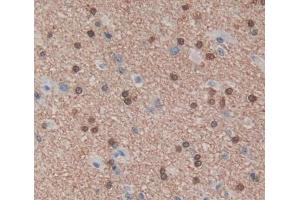 Used in DAB staining on fromalin fixed paraffin- embedded brain tissue (PUF60 antibody  (AA 226-549))