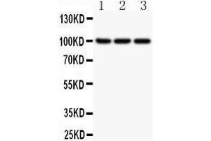 Anti-NFkB p100 Picoband antibody,  All lanes: Anti NFKBP100  at 0. (NFKB2 antibody  (AA 1-340))
