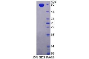 SDS-PAGE analysis of Rat PDE3A Protein.