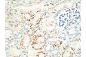 Immunohistochemistry (IHC) image for anti-Antigen Identified By Monoclonal Antibody Ki-67 (MKI67) antibody (ABIN3181134) (Ki-67 antibody)